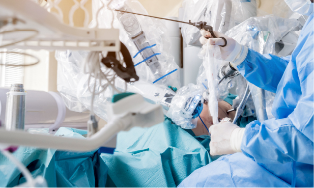 Doctor Mahmut Dogan Gastric Sleeve Surgery